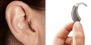 Title: Open Ear Hearing Device