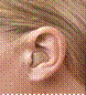 Title: In the Ear Device